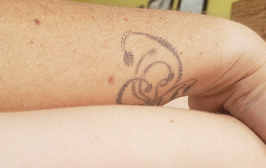 Meu braço, minha perna